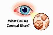 What causes corneal ulcers?